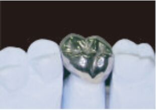 Купить Полная металлическая корона и мост высокая точность серебряная временная корона online manufacture