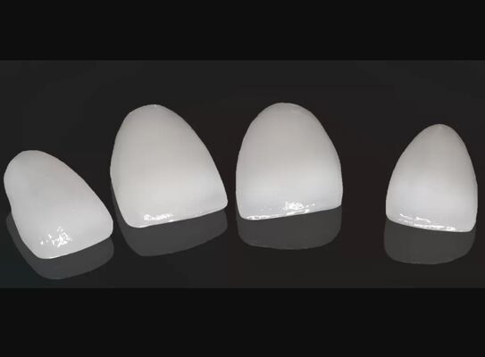 Купить Высокая эстетика Композитная корона Onlay Veneer Настраиваемый размер online manufacture