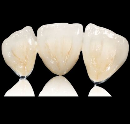 Купить Настраиваемая полудрагоценная корона или мост драгоценный сплав корона и мост online manufacture