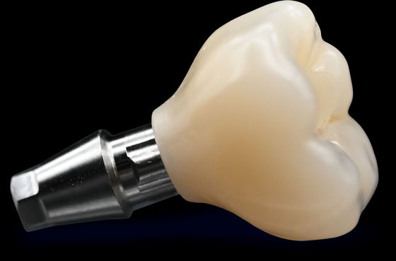 CAD / CAM Имплантат Короновая мостик Высокая эстетика Цирконовая корона