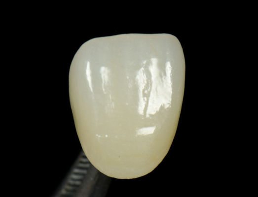 Настраиваемый Emax Press Crown Fast And High Esthetics Dental Inlay Onlay