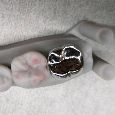 Полная металлическая корона и мост высокая точность серебряная временная корона
