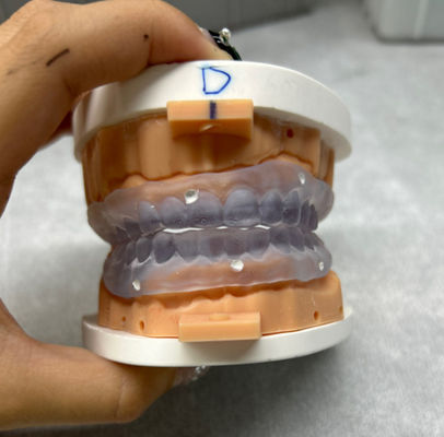 Настраиваемые 3D-печатные зубные протезы попробуйте в цифровой полный протез