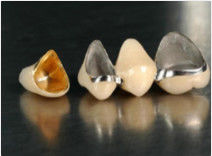 Благородная драгоценная корона из сплава и мост Желтая временная корона